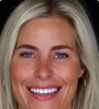Après les soins dentaires, femme blonde