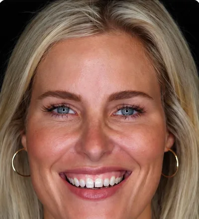 Avant les soins dentaires, femme blonde