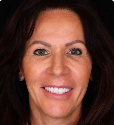 Après les soins dentaires, femme brune