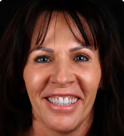Avant les soins dentaires, femme brune