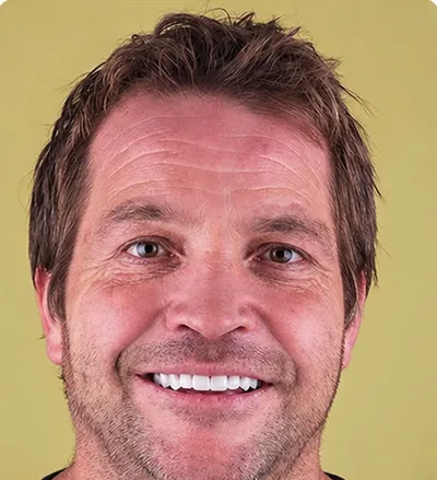 Après les soins dentaires, homme aux dents usées